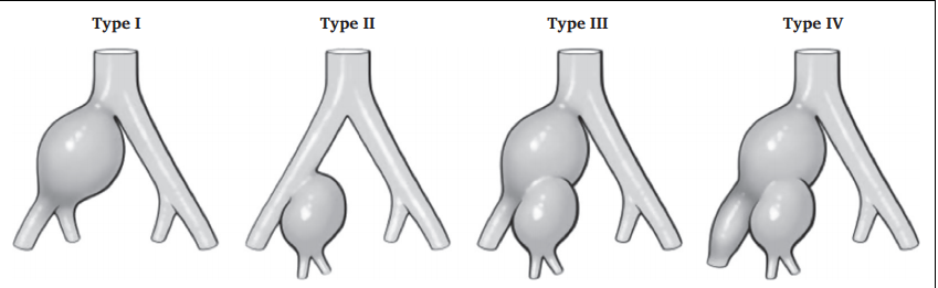 15a